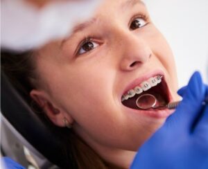 Dental Braces Adelaide – Patient in Dental Chair Girl in a dental chair receiving care for dental braces Adelaide